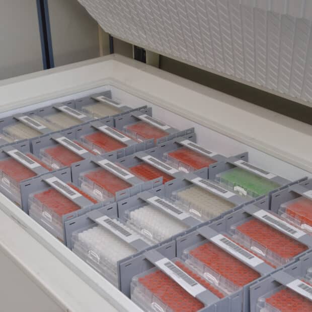Freezer Racks - Sample Management - NBS Scientific